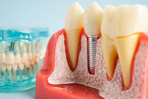 Best Dental Exams and Cleanings  in Milam, TX